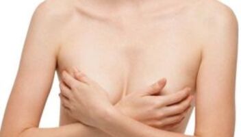 Женщина, которой необходима пластическая операция на груди (маммопластика)