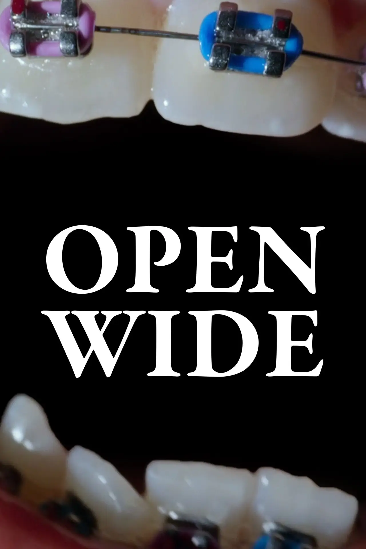 Постер до фільму "Open Wide"