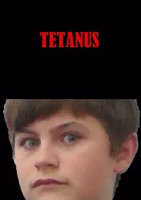 Tetanus