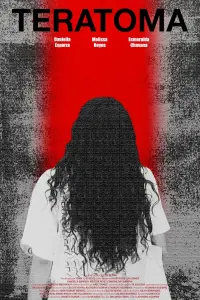 TERATOMA