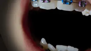 Задник до фильму"Open Wide" #761419