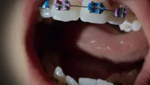 Задник до фильму"Open Wide" #761416