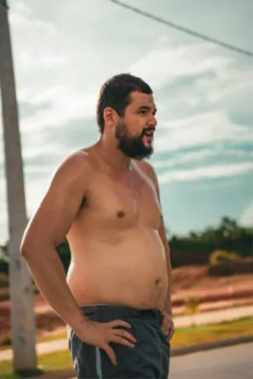 Obeso Mórbido