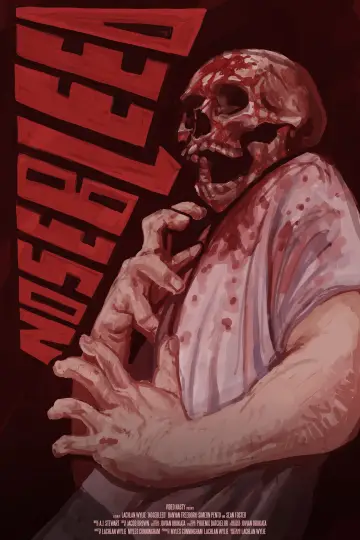 Nosebleed
