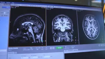 Задник до фільму "Migraine : la fin du casse-tête ?" #1915594