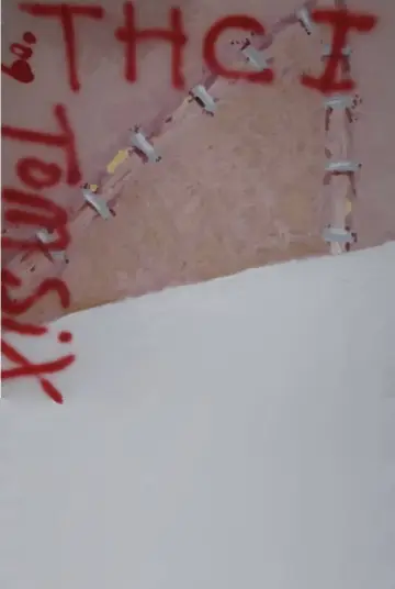 Постер до фільму "The Human Centipede (First Sequence)" #1630434