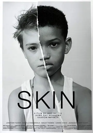 Постер до фильму"Skin" #735809