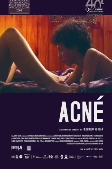 Постер до фильму"Acné" #1171126