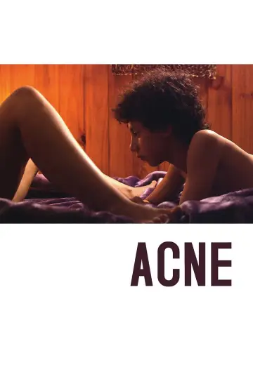Acné постер