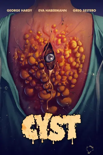 Постер до фильму"Cyst" #41716