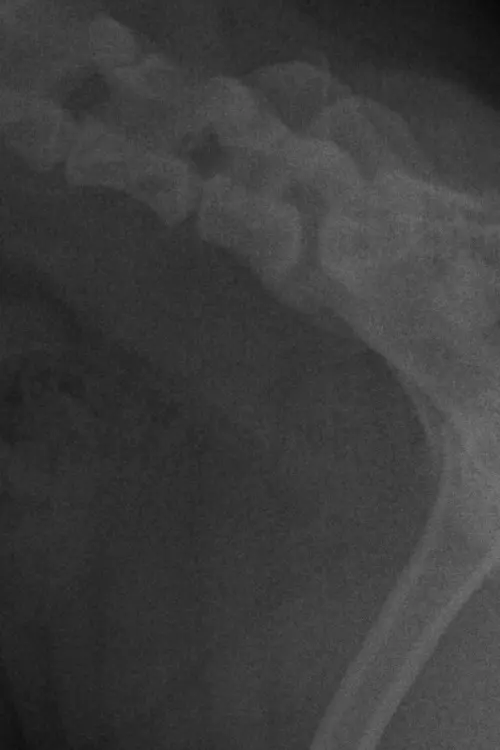 Постер до фільму "LA CARIE."