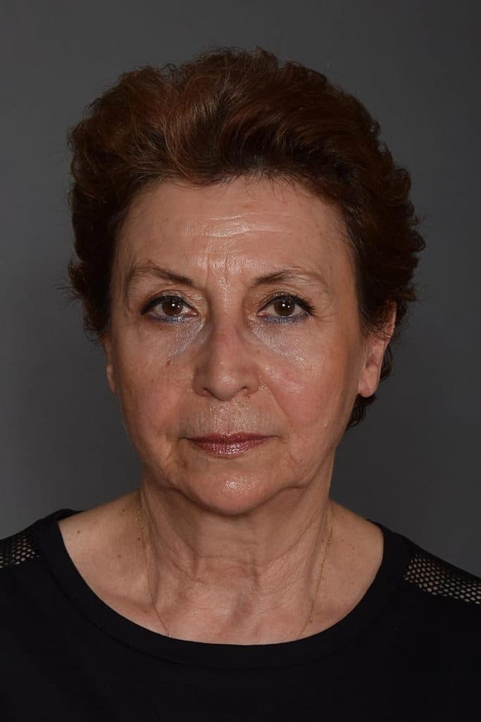 Фото  (Serra Menderes)