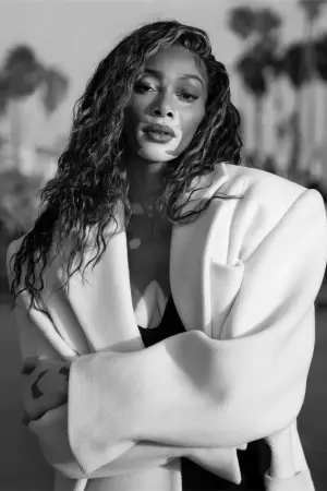 Фото Вінні Гарлоу (Winnie Harlow) #155995