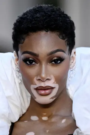 Фото Вінні Гарлоу (Winnie Harlow) #330233