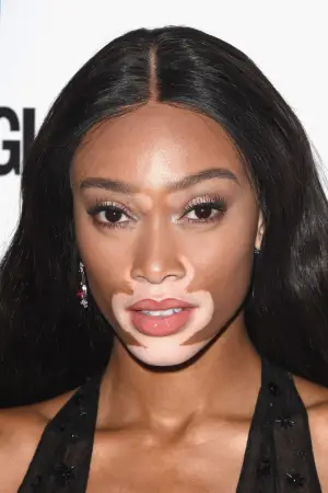 Фото Вінні Гарлоу (Winnie Harlow) #330232