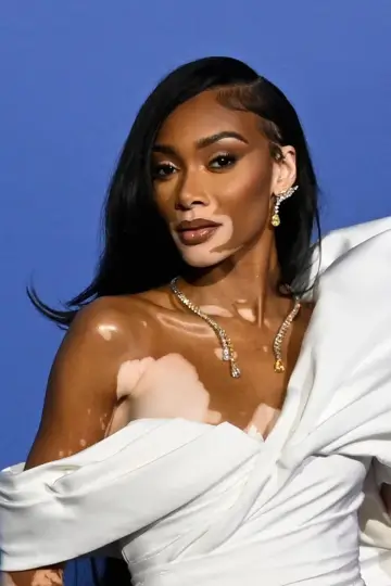 Фото Вінні Гарлоу (Winnie Harlow) #155993