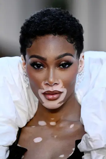 Фото Вінні Гарлоу (Winnie Harlow) #330231