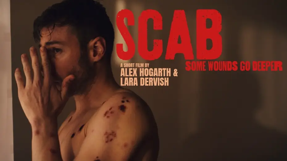 Відео до фільму Scab — SCAB | Official Teaser | Body Horror