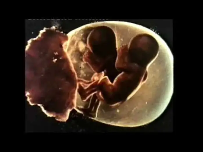 Відео до фільму Sisters — Sisters (1973) - Trailer