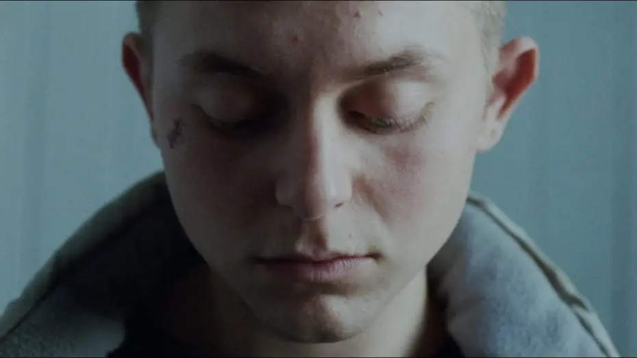 Відео до фільму Skunk | Skunk - Official Trailer