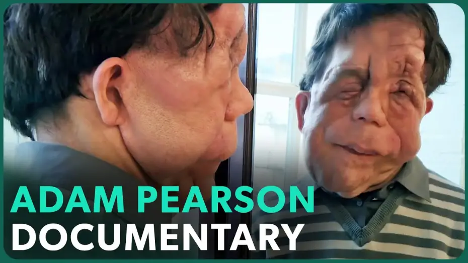 Відео до фільму The Ugly Face of Disability Hate Crime | The Ugly Face of Disability Hate Crime (Adam Pearson Documentary) | Real Stories