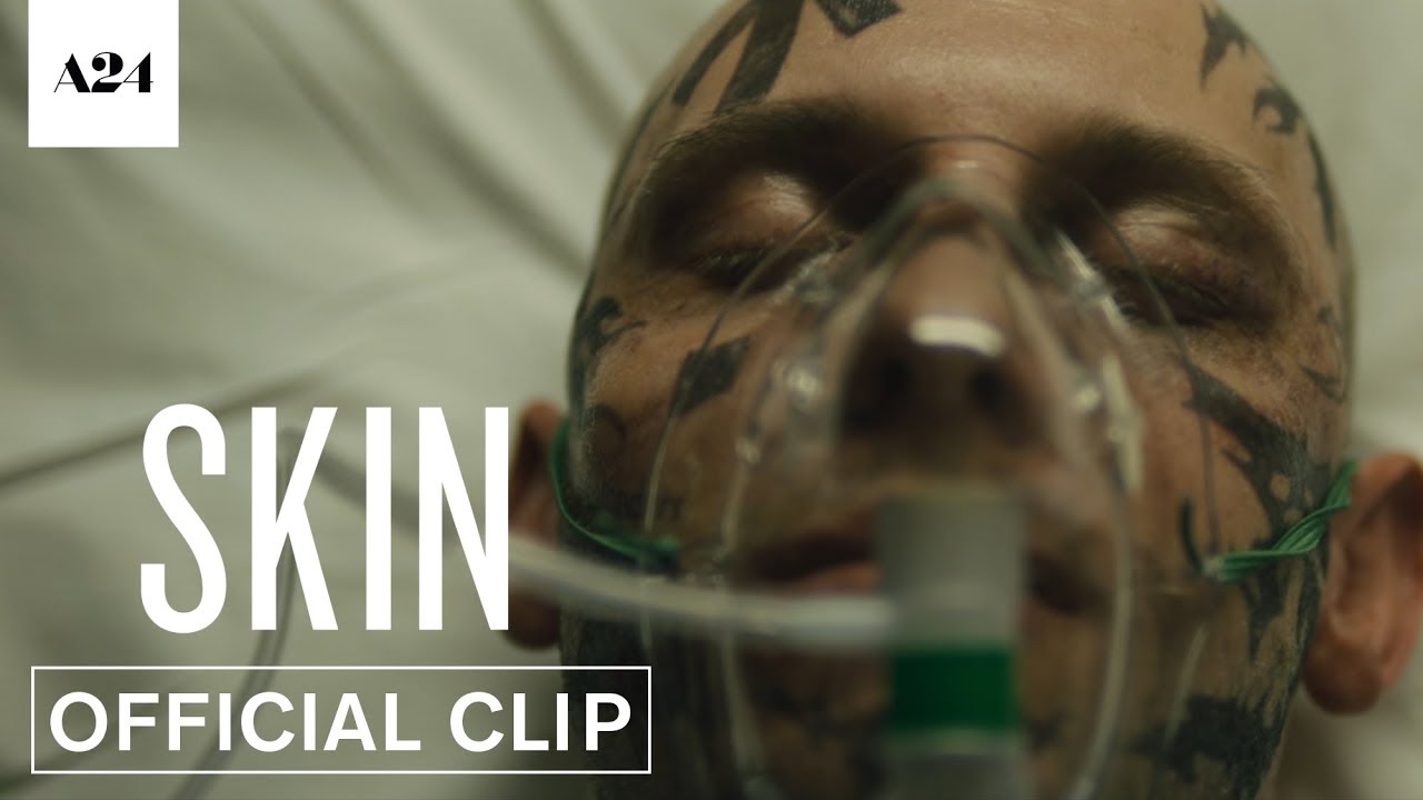 Відео до фільму Скін | In the Hospital