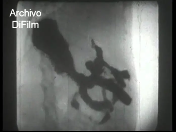 Відео до фільму R&ouml;ntgenstrahlen | DiFilm - Los rayos X - Un film cultural de la UFA 1937