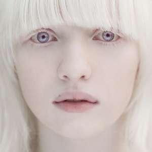 Девочка альбинос