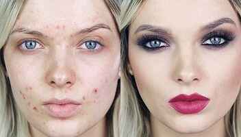 Модель для макияжа (с проблемами кожи на лице)