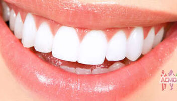 Люди с КРАСИВЫМИ зубами, 35-55 лет - кастинг на рекламу.
