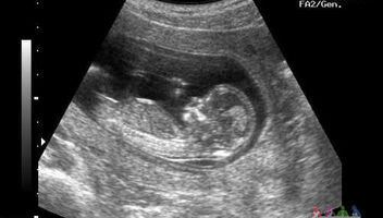 Девушка в положении (около 16 недель) ожидающая доченьку.
