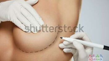Фотосъемка в клинике на тему пластики груди
