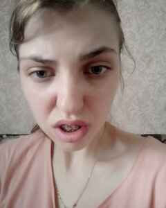 Анна Хорошко Роздратування