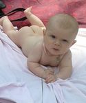 Апролдж  Скепсис